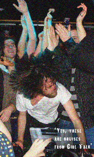 yes these are bruises from girl talk